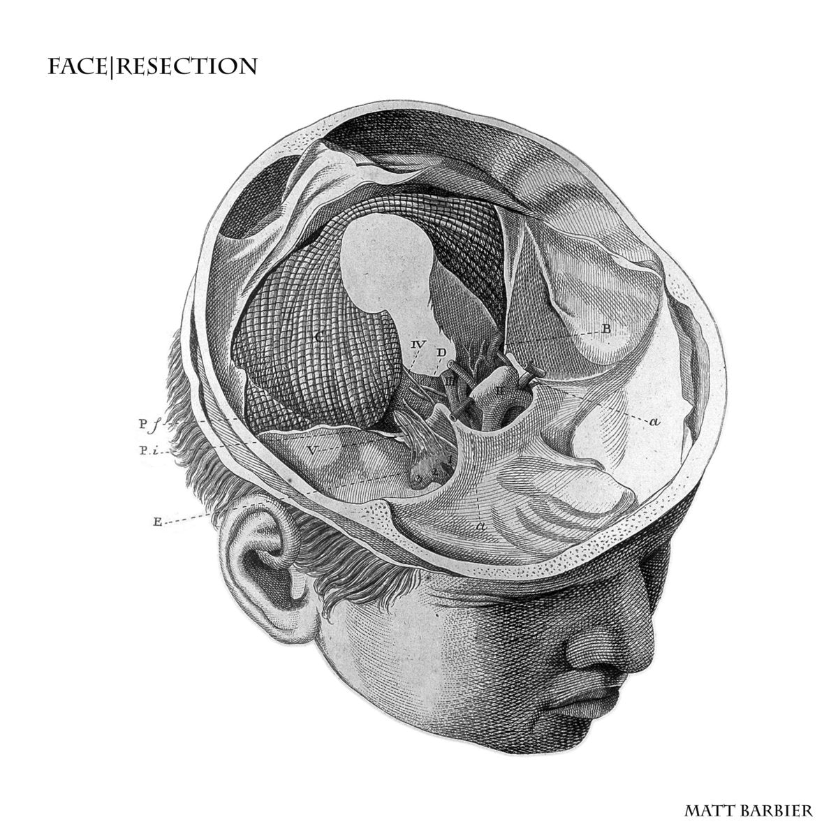 Matt Barbier – Face|Resection [USED 10"]